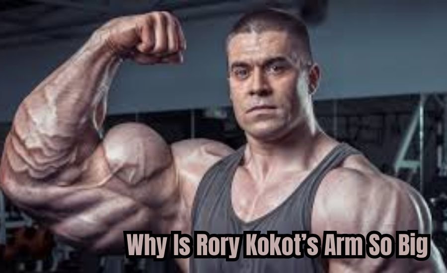 why is rory kokot's arm so big